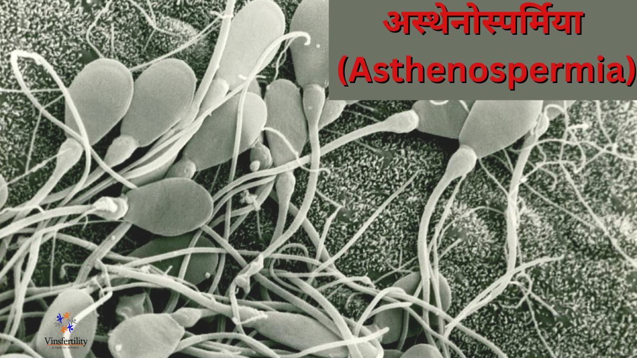 अस्थेनोस्पर्मिया (Asthenospermia): कारण, लक्षण, और उपचार