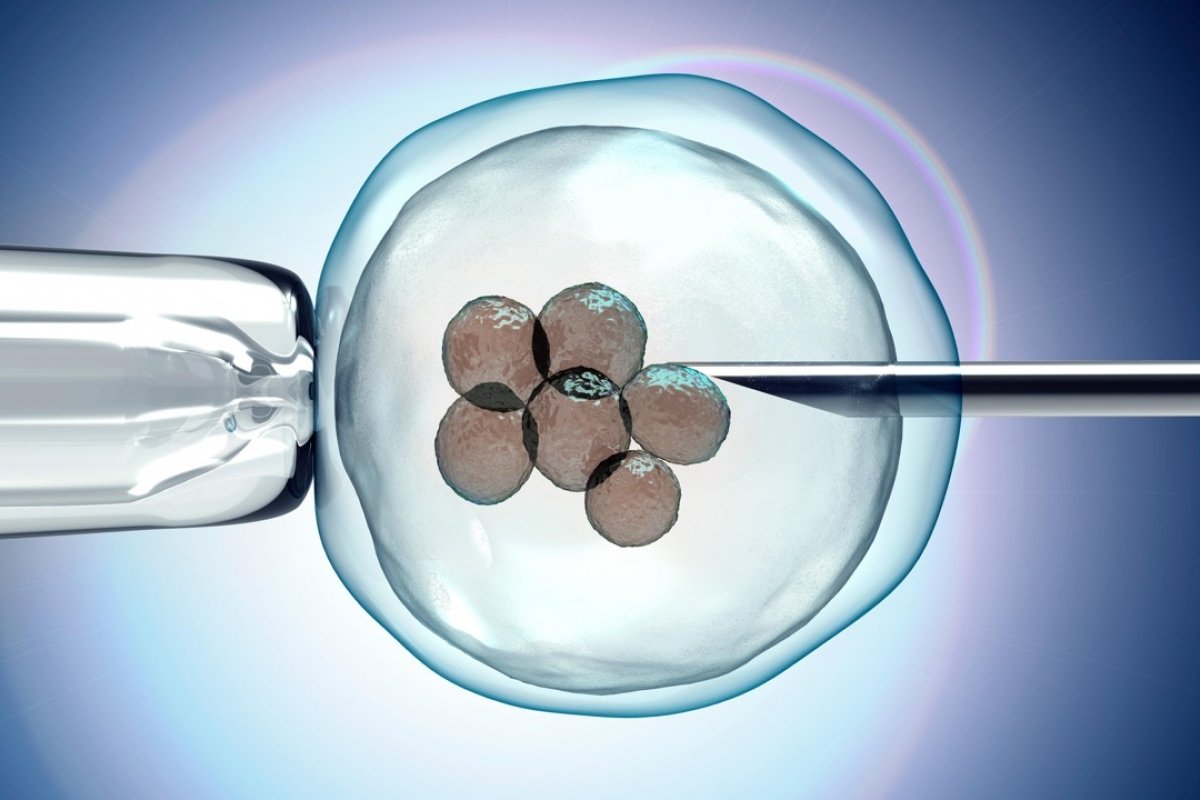IVF WITH SELF EGG