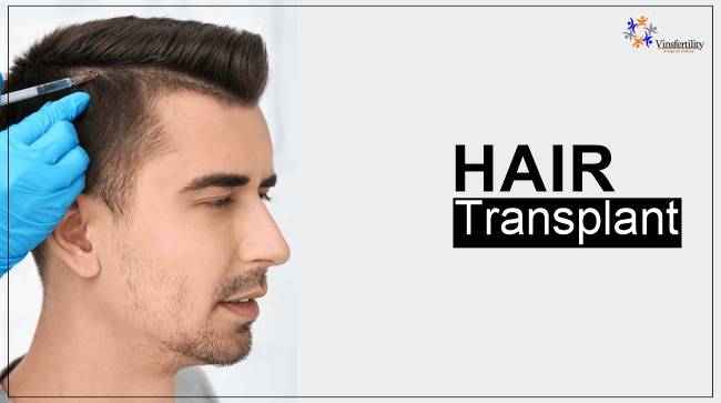 Hair-Transplant