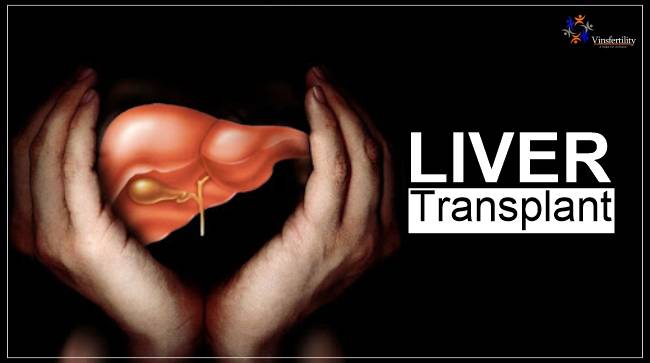 Liver-Transpalnt