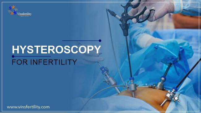 HYSTEROSCOPY