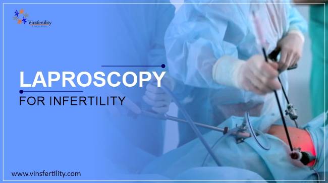 LAPROSCOPY