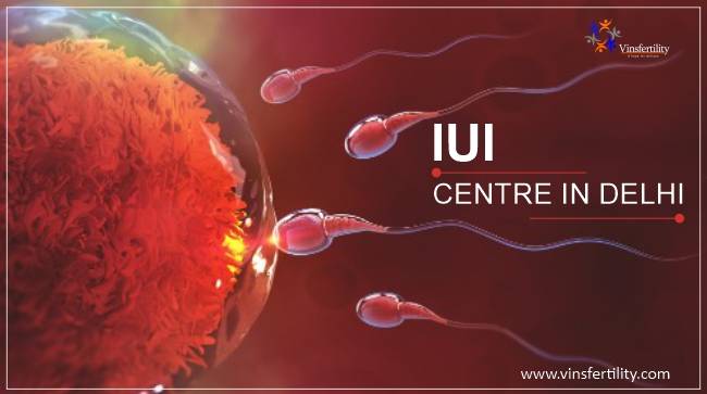 iui centre in delhi