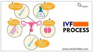 ivf-process